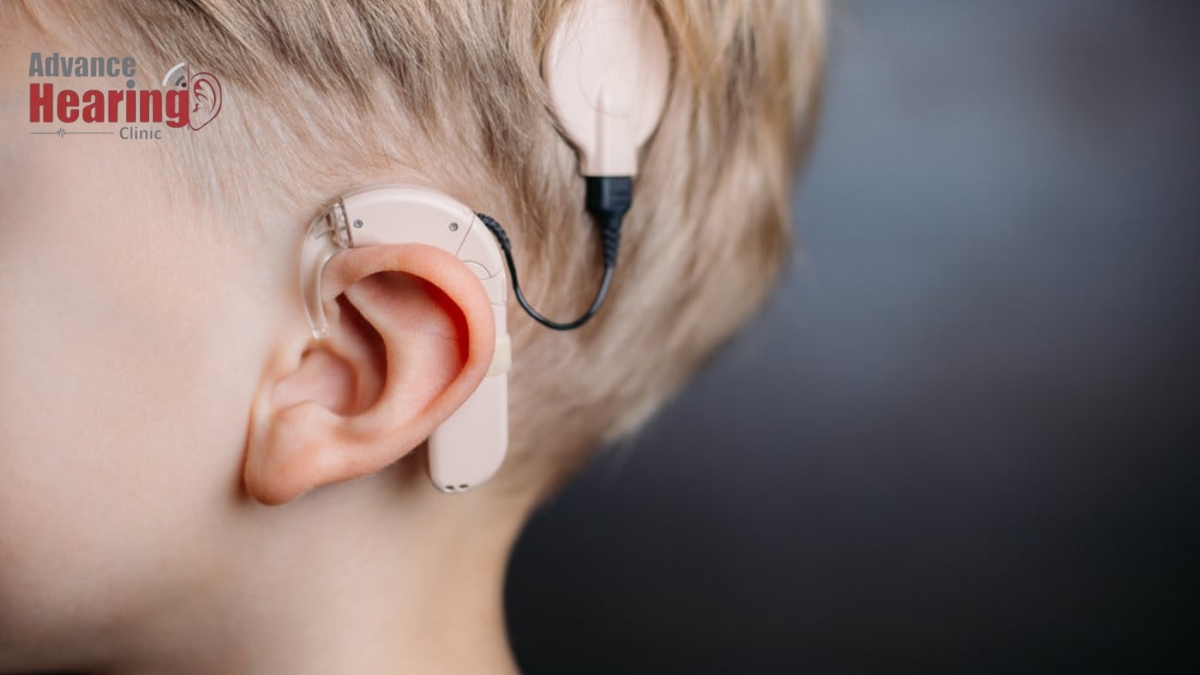 Cochlear Implants